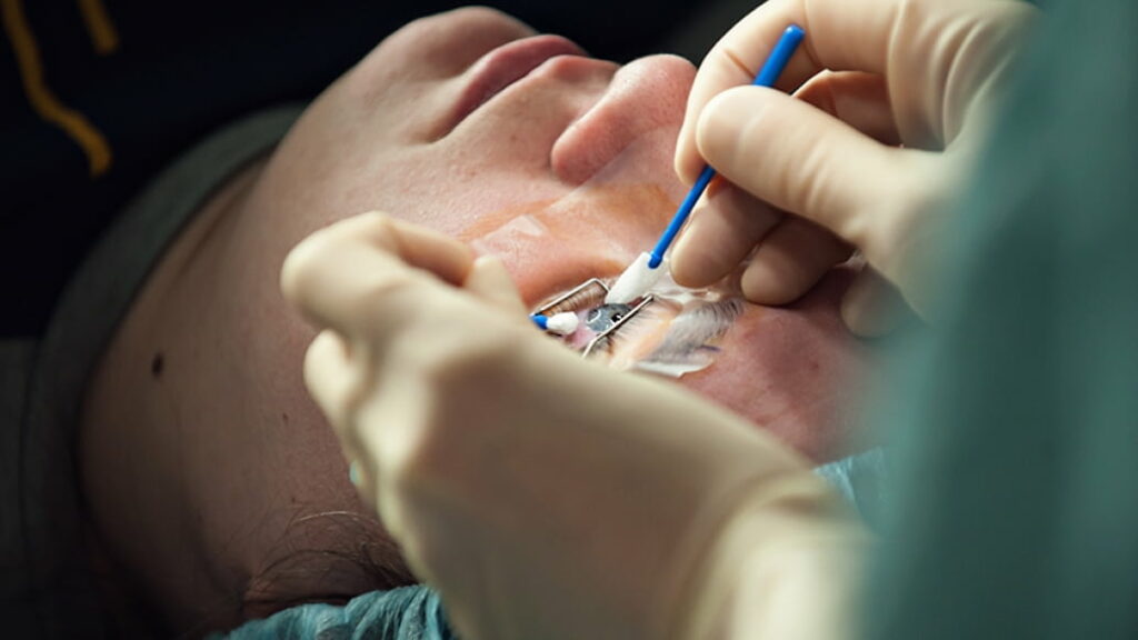 Cost Of Lasik Surgery